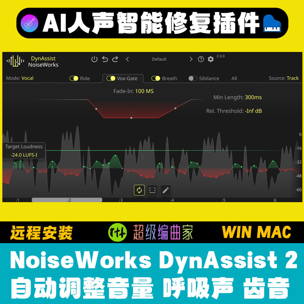 🎧 Plugin – NoiseWorks DynAssist 2.2.0 – AI Vocal Auto Repair & Mixing Assistant (Mac) ✨ [ MICHIGO STUDIO ]